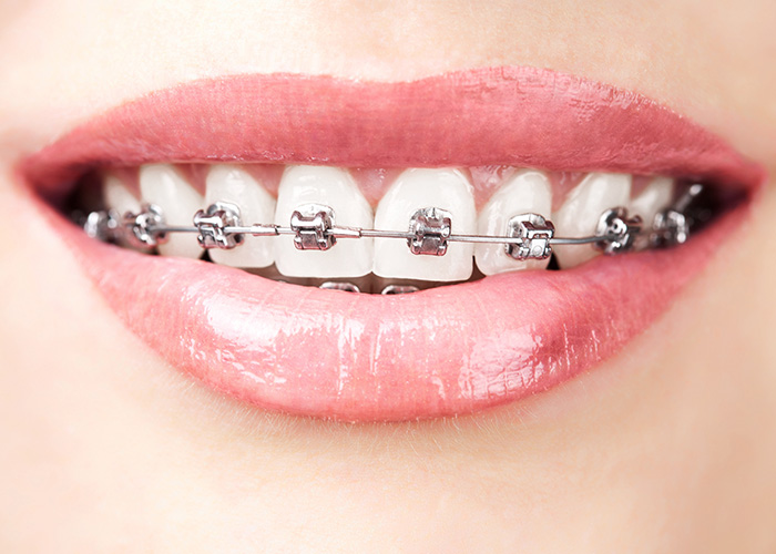 Lesley Holloway the Dentist | Orthodontics, Sedation Dentistry and Preventative Program